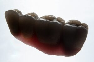 Dental Sealants